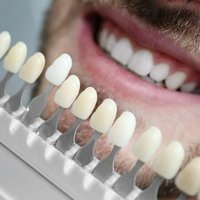 Image of Emergency Dentist Bucks County
