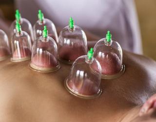 Cupping therapy