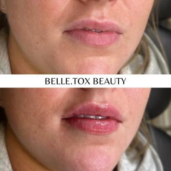 Image de Belle.tox Beauty