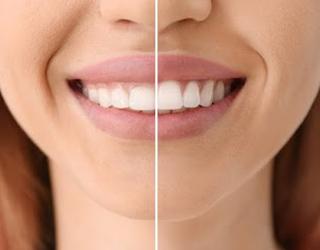 Image of The Elms Dental Centre