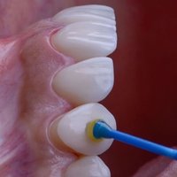 Image of Emergency Dentist Bucks County