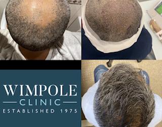 Image of Wimpole Hair Transplant Clinic Newcastle
