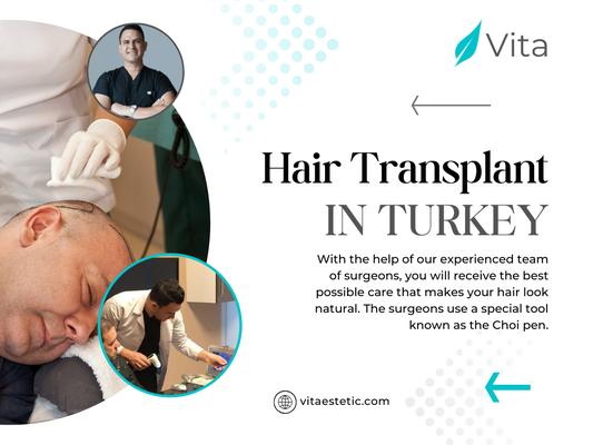 Hair Transplant in Turkey