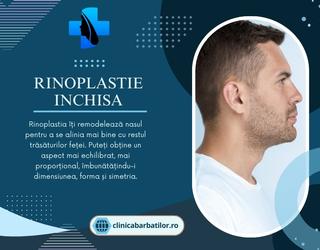 Rinoplastie Inchisa