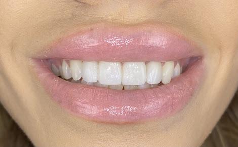 Image of Dr Chip Webb - Top Arizona Cosmetic Dentist