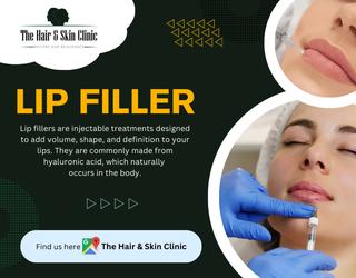 Lip Filler Treatment