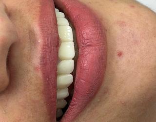 صورة Isra Dental Clinic الدكتورة اسراء حجازي