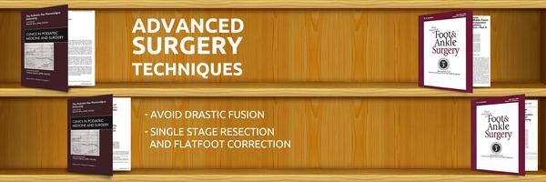 Image of Tarsal Coalition Surgery