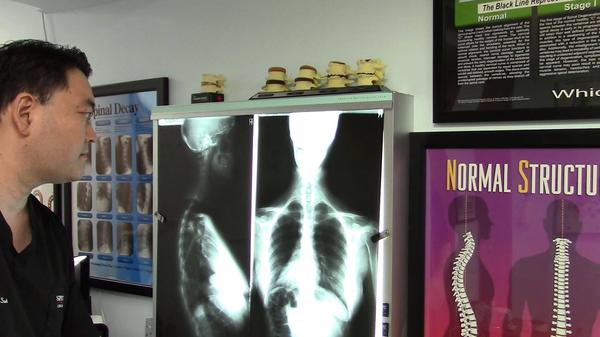 Image of Specific Chiropractic