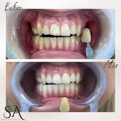 Image of Smile Aesthetics by Jamie