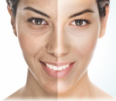 Image of Spring Laser & Skin Care