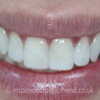 Inspire Dental Southend  photo