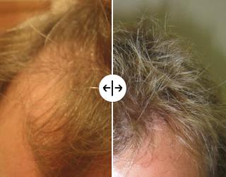 Image of Wimpole Hair Transplant Clinic Newcastle