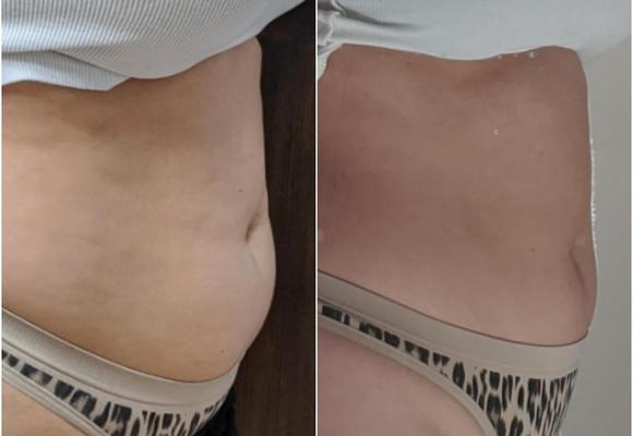 Image de GLO Laser & Body Studio
