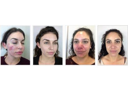 Clear Path Acne Clinic Austin North