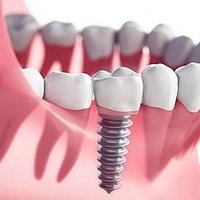 Image of Albany Dental Associates