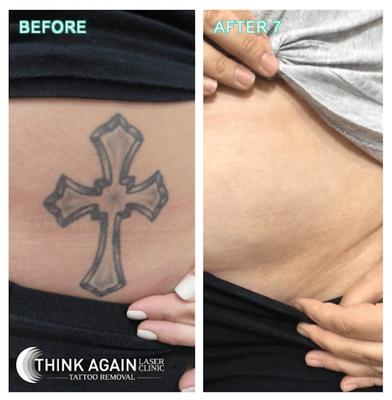 Image of Think Again Laser Clinic – Auckland