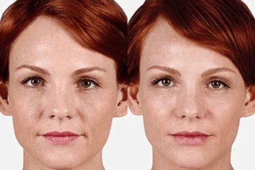 Image of Ultra Smooth Skin