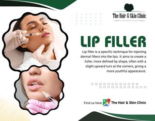 Lip Filler