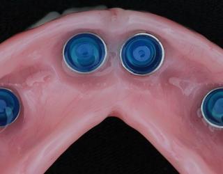 Afbeelding van Harmony Dental Laboratory