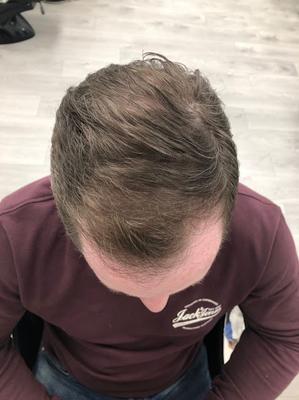 Image of Este Hair Medical London