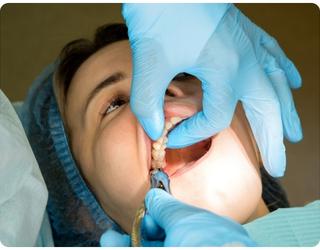 Wisdom Teeth Removal Springvale