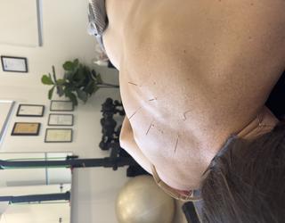 Image of PACT Physio & Rehab
