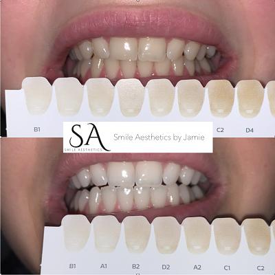Image of Smile Aesthetics by Jamie