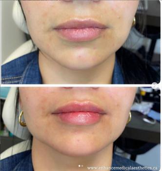 Image of Enhance Medical Aesthetics
