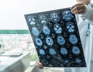 Traumatic Brain Injury Attorney Austin
