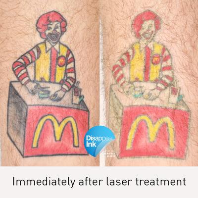 Image of Disappear Laser Clinic + Tattoo Removal