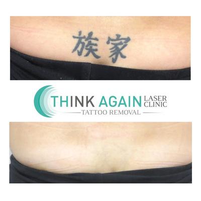 Image of Think Again Laser Clinic – Auckland