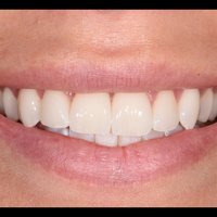 Image de A Smile Above