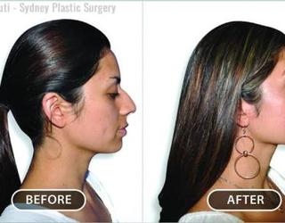 Image of Sydney Plastic Surgery