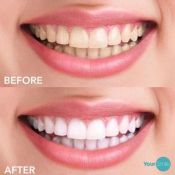 Image of Your Smile
