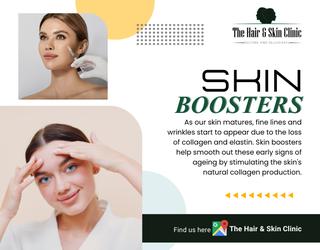 Skin Boosters Treatment
