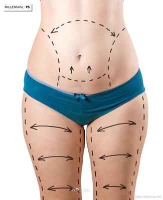 Image of Millennial Plastic Surgery