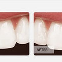 Image of Emergency Dental NE Philadelphia